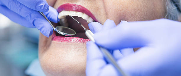 Best Emergency Care for Gum Disease in Union City, GA